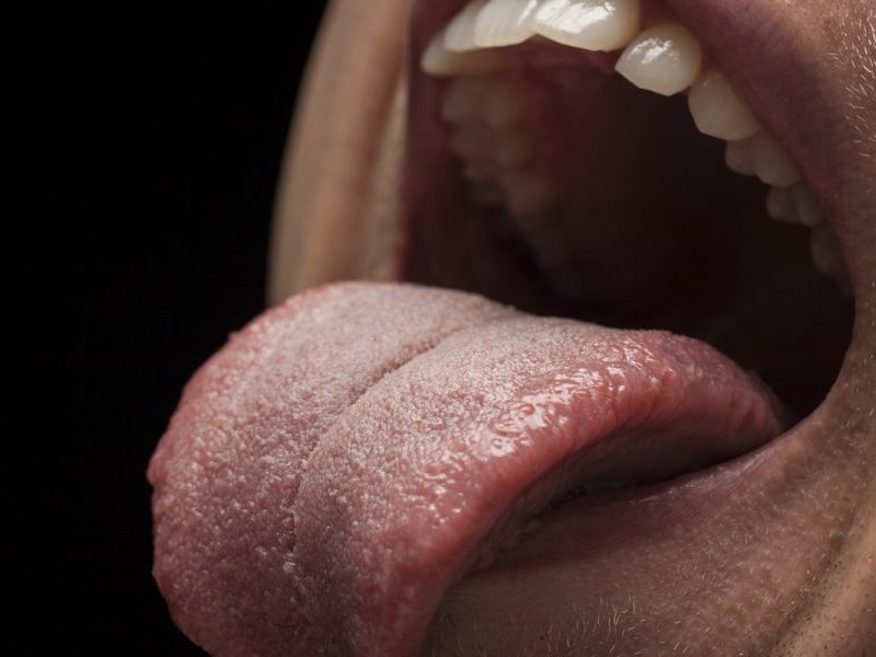 Bactérias bucais influenciam velocidade do raciocínio