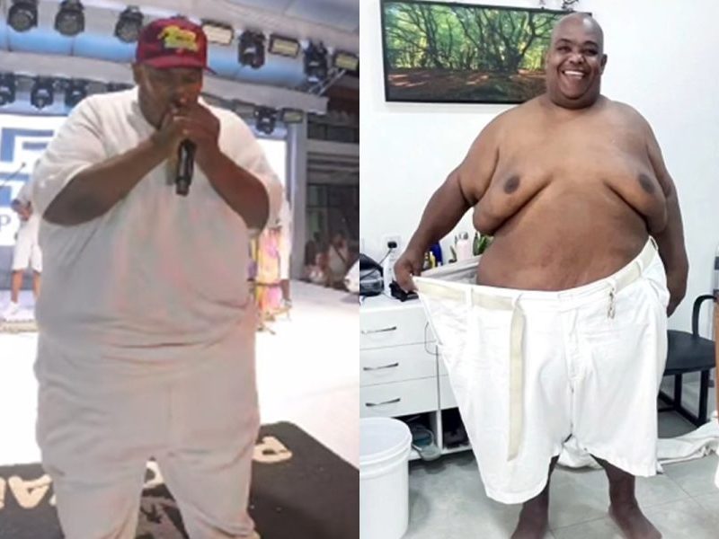 Vocalista do Pagodart emagrece 108 kg e planeja retorno