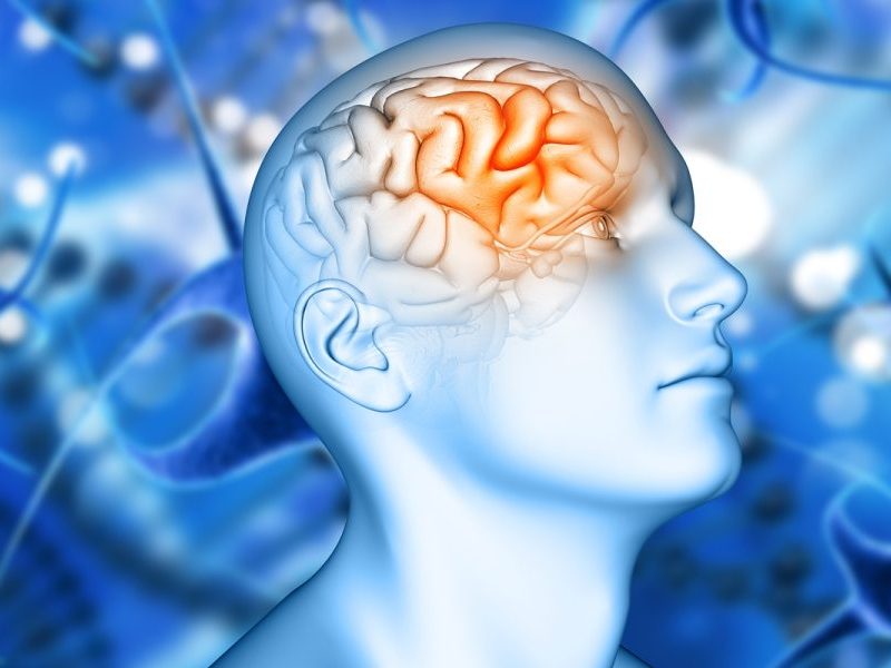 Nova variante genética descoberta pode triplicar risco de Alzheimer