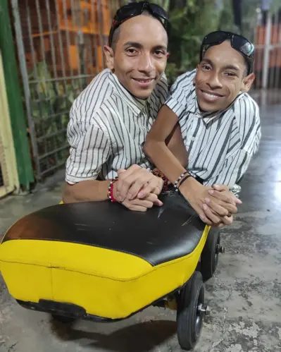 Morrem aos 27 anos gêmeos siameses que eram sucesso na internet