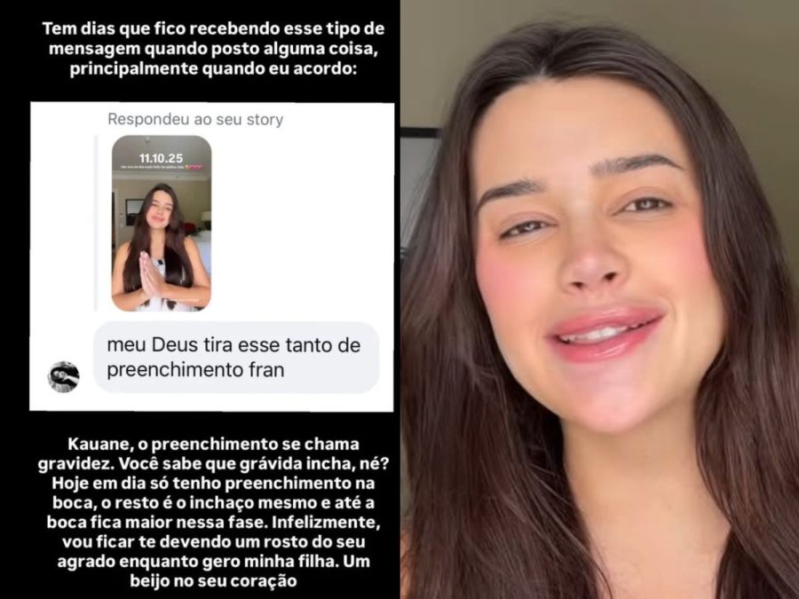 Grávida, Franciny Ehlke é criticada por preenchimentos e rebate: “Chama gravidez”