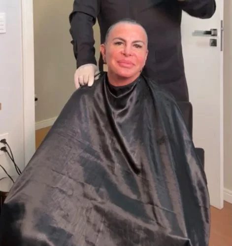 Gretchen mostra ao vivo resultado de transplante capilar após diagnóstico de alopecia; veja antes e depois Gretchen mostra resultado de transplante capilar após diagnóstico de alopecia e comemora: “Estou linda de novo”; assista! (Foto: Reprodução/ Instagram)