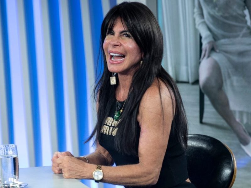 Gretchen tira peruca ao vivo e mostra resultado de transplante capilar