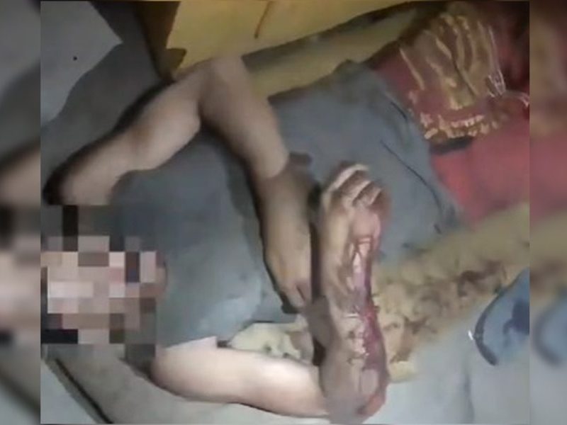 Homem desmaia após espancamento em Luziânia