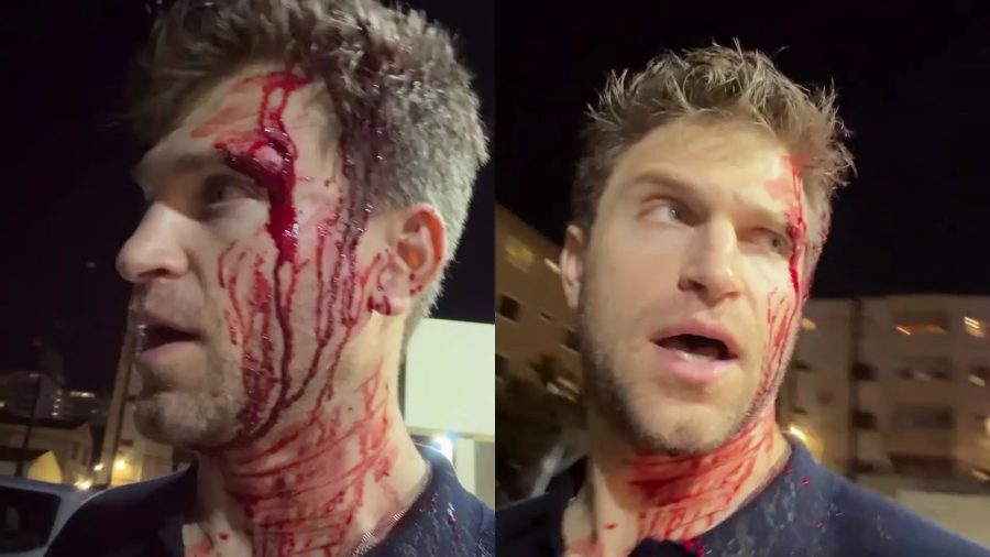 Keegan Allen, de “Pretty Little Liars”, é assaltado em LA e choca com vídeo ensanguentado: “Apontaram a arma” Keegan Allen, de “Pretty Little Liars”, é assaltado em LA e choca com vídeo ensanguentado: “Apontaram a arma”