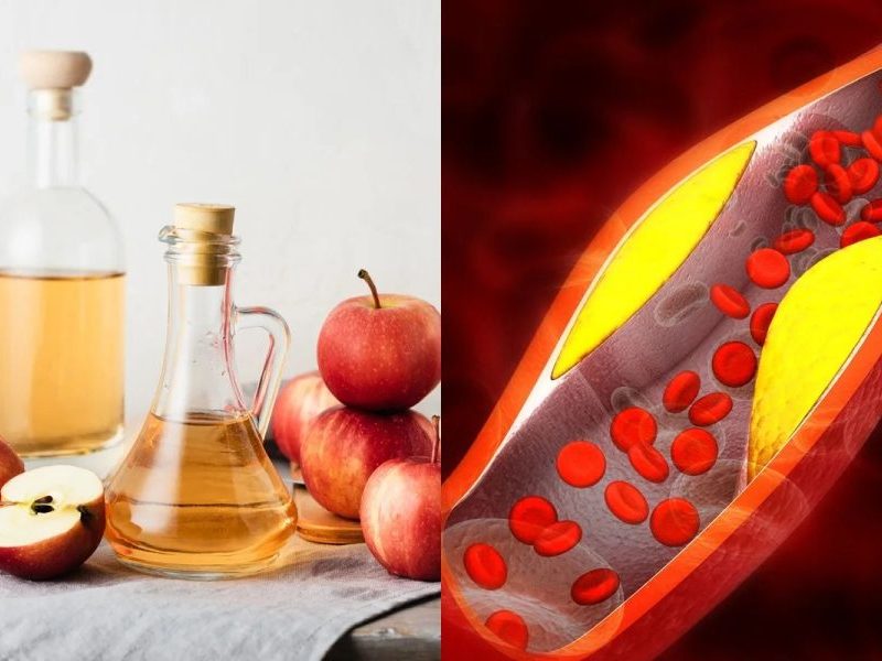 Vinagre de maçã ajuda a controlar o colesterol? Entenda
