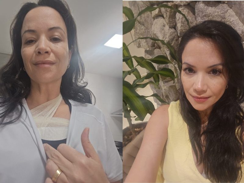 Psiquiatra diagnosticada com câncer de mama inverte papéis