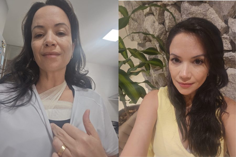 "Preciso viver o agora", diz psiquiatra que descobriu câncer de mama aos 45