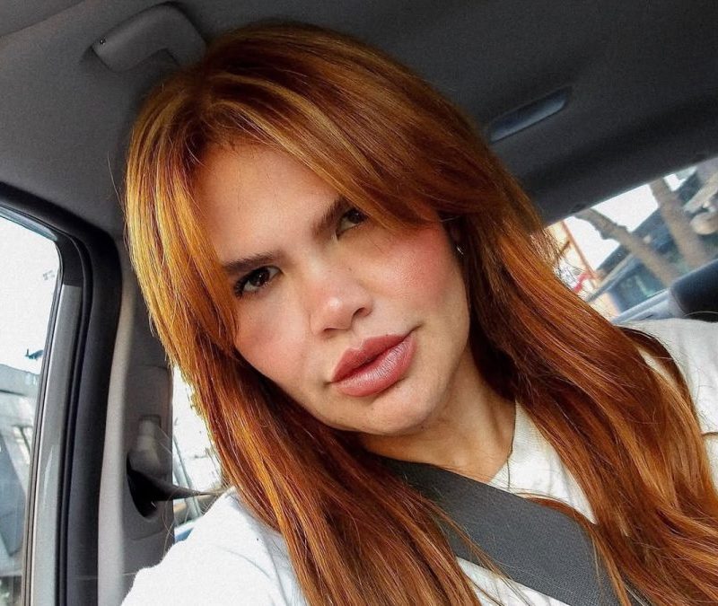 Thais Carla completa 35 anos e planeja cirurgias reparadoras