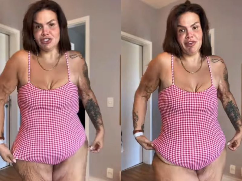 Thais Carla sobre excesso de pele após perder 120 kg: “Não deixo de viver”