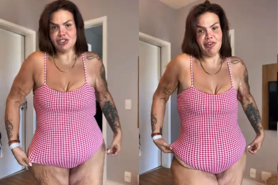 Thais Carla sobre excesso de pele após perder 120 kg: “Não deixo de viver”